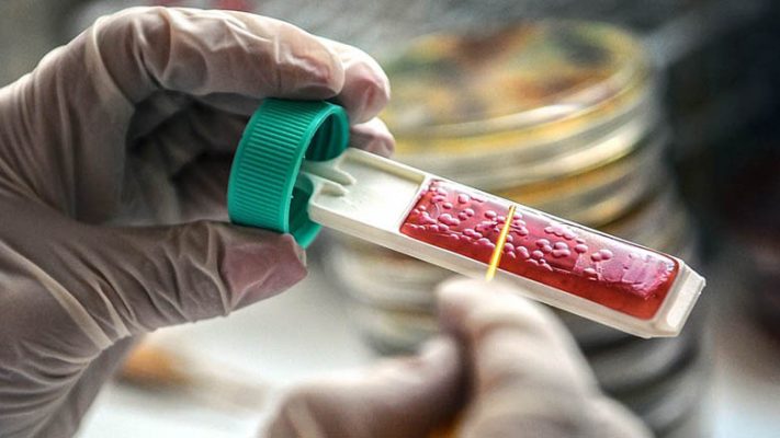 Rastet e mpiksjes së gjakut pas marrjës së vaksinës AstraZeneca/ Shkencëtarët besojnë se kanë gjetur shkakun
