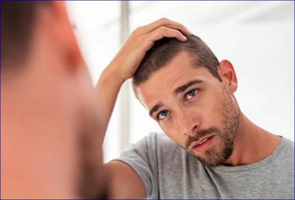 Rënia e flokëve te burrat, çfarë e shkakton