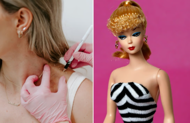 ‘Barbie Botox’, çfarë është trendi i fundit në TikTok që po çmend vajzat