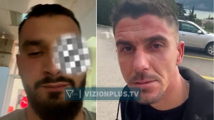 Dhunimi i shqiptarëve në Malin e Zi, reagon policia: Jemi në kontakt me autoritetet malazeze, të rinjve iu është ofruar ndihma jonë