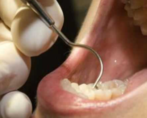 Dhimbja e dhëmbit tregon se keni probleme në këtë organ të trupit