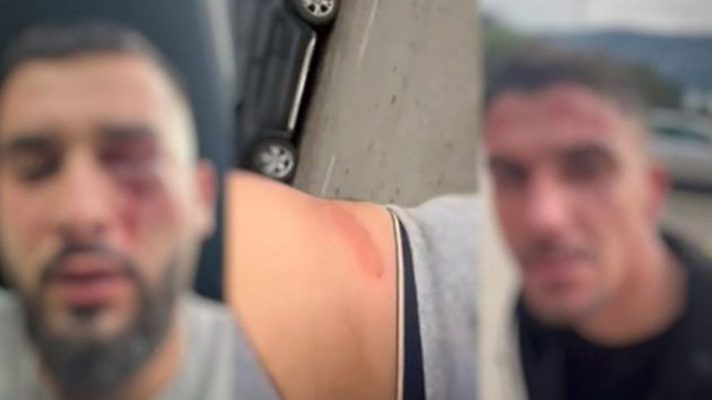 “Na goditën në kokë dhe në trup”, si u dhunuan tre shqiptarët në Malin e Zi, çfarë dihet deri tani për ngjarjen