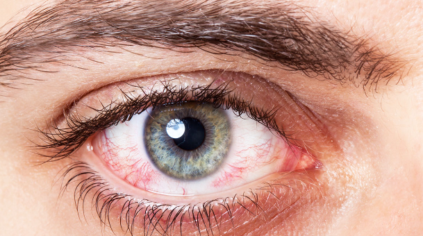 Ngjyra dhe forma e syve, tregues të rëndësishëm të shëndetit të njeriut