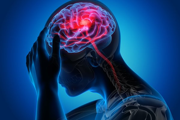 Nga të vjellat te problemet me sytë, 8 simptomat e dukshme të hemorragjisë së trurit