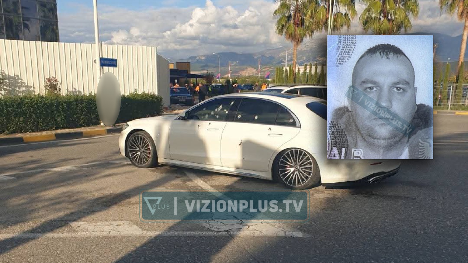 FOTO  U plagos me plumb në kokë në atentatin ndaj krahut të djathtë të Shullazit  ky është agjenti i AMP së