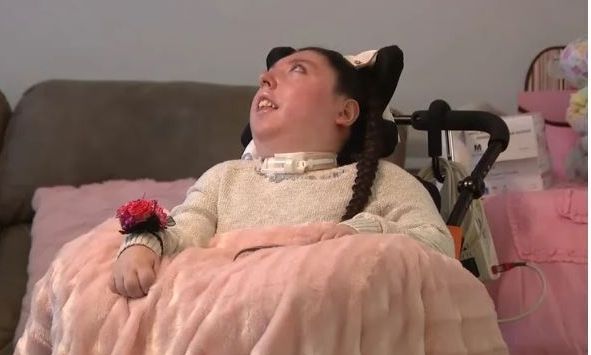 E jashtëzakonshme  Mjekët i dhanë 4 vjet jetë  vajza e lindur pa tru mbush 20 vjeç