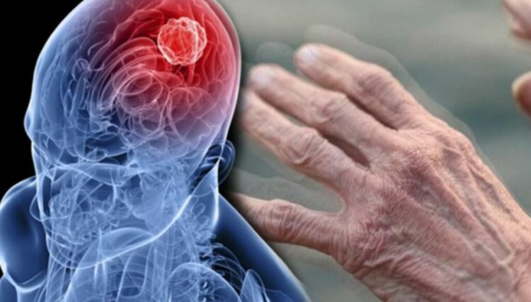 Sëmundja Parkinson mund të lidhet me ujin  çfarë thonë studimet e fundit