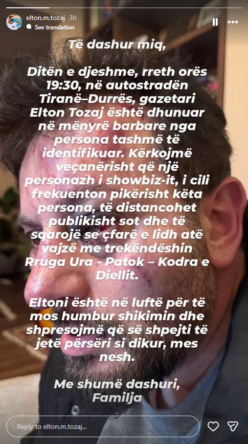 Dhunohet brutalisht gazetari Elton Tozaj  rrezikon të humbasë shikimin nga njëri sy