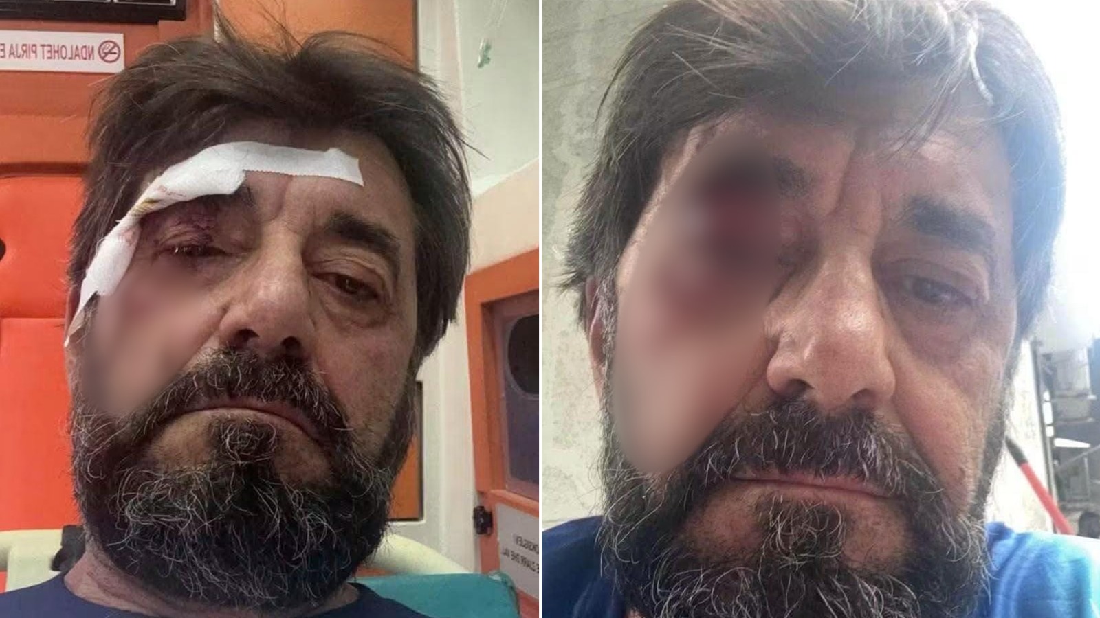 Dhunohet pranë banesës gazetari Ilir Demaliaj