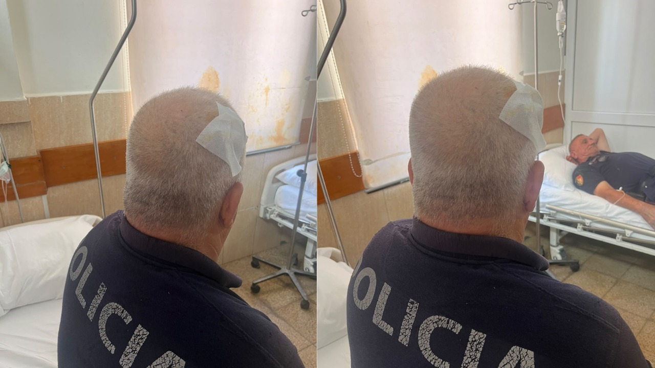 Përplasjet mes protestuesve dhe policisë jashtë Kuvendit  tre efektivë të lënduar