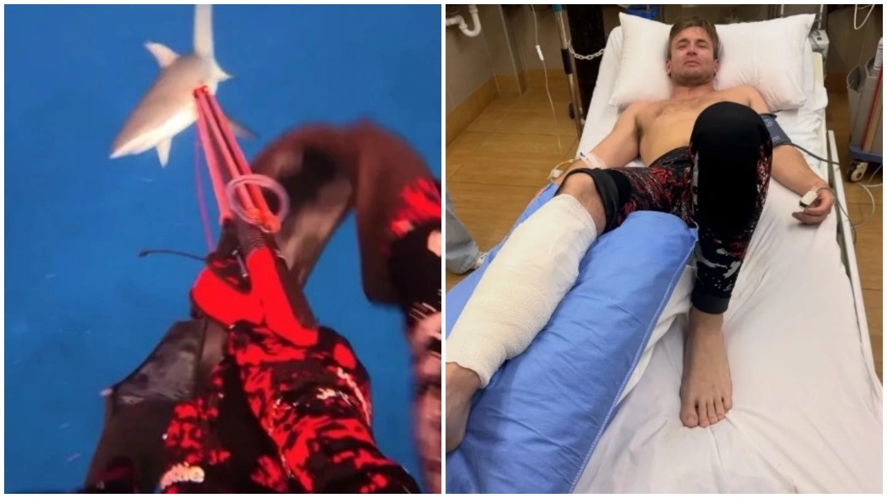 Peshkaqeni sulmon influencerin në Fixhi  i nënshtrohet katër operacioneve për të shpëtuar këmbën  VIDEO 