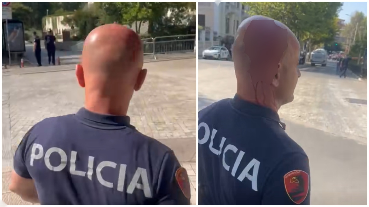 Balla publikon pamjet e policit të mbuluar në gjak  Kjo nuk është më protestë paqësore  por terrorizëm