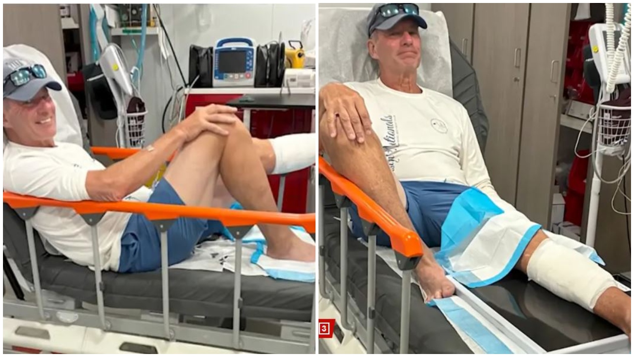 Pushimet u kthyen në makth  peshkaqeni kafshon 69 vjeçarin në Bahamas